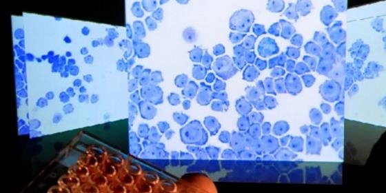 Aspirina em simultâneo com imunoterapia pode aumentar eficácia do combate ao cancro