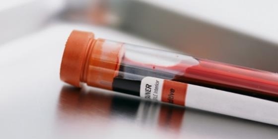 Prémio “Nação Inovadora” distingue invenção de "kit" para detetar tipo de sangue