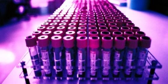 Portugueses premiados em Espanha por teste inovador para o cancro da bexiga