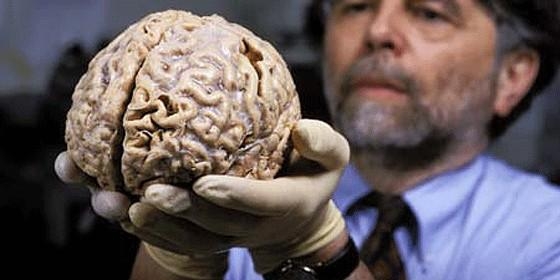 Descoberta parte do cérebro responsável pela perturbação compulsiva e hiperativa